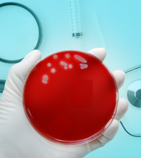 Gronkowiec złocisty (MRSA) Staphylococcus aureus zarażenia, objawy, leczenie oraz profilaktyka