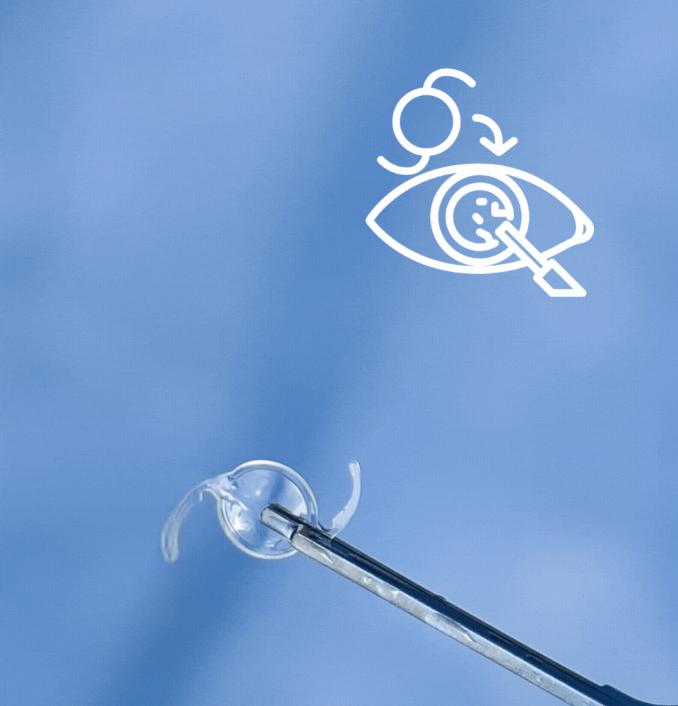 Zaćma vs. Plastyka Powiek, który zabieg powinieneś wykonać najpierw