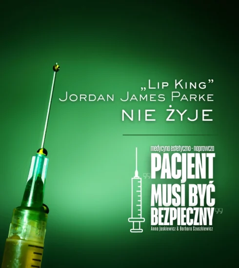 Jordan James Parke LIP KING NIE ZYJE