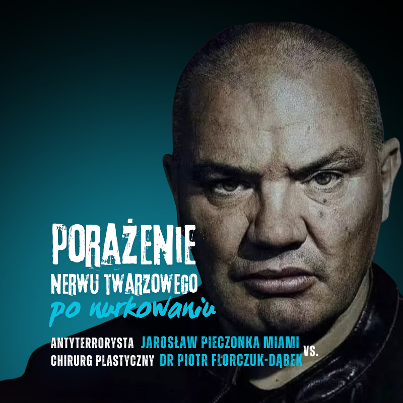 Porazenie nerwu twarzowego